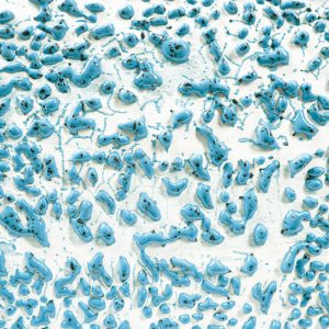 Speckled Teal 16-oz. Amaco Crawl Mid-Range Glaze